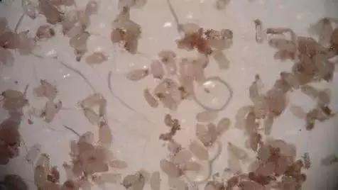 家庭祛除螨虫的有效方法是什么,家里有螨虫用什么东西除螨好