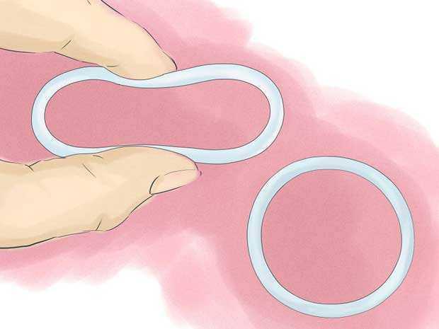 节育环位置正常会出血吗,女性节育环对身体有哪些危害