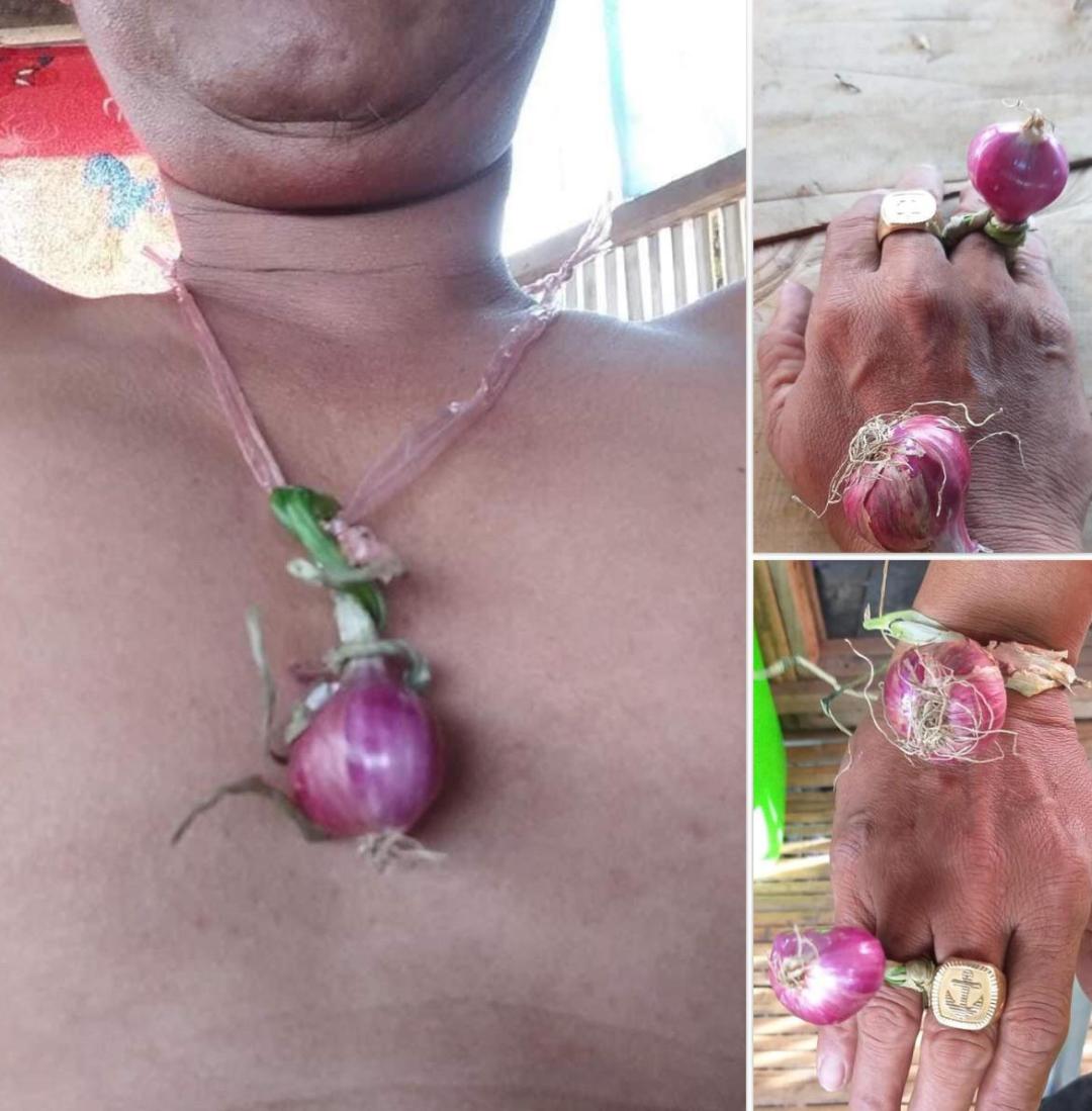 菲律宾洋葱的价格,菲律宾洋葱危机