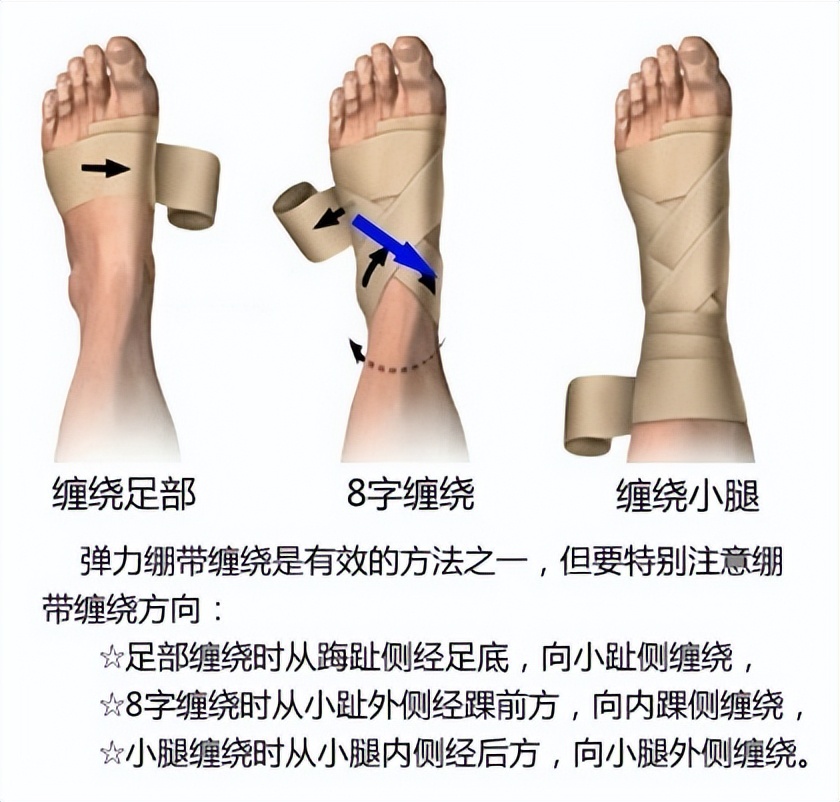 内马尔脚踝90度扭伤姆巴佩,内马尔脚踝受伤巴黎圣日耳曼