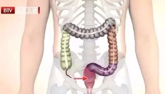 肠胃不好吃什么养护肠道,肠道不好有八种东西不能吃