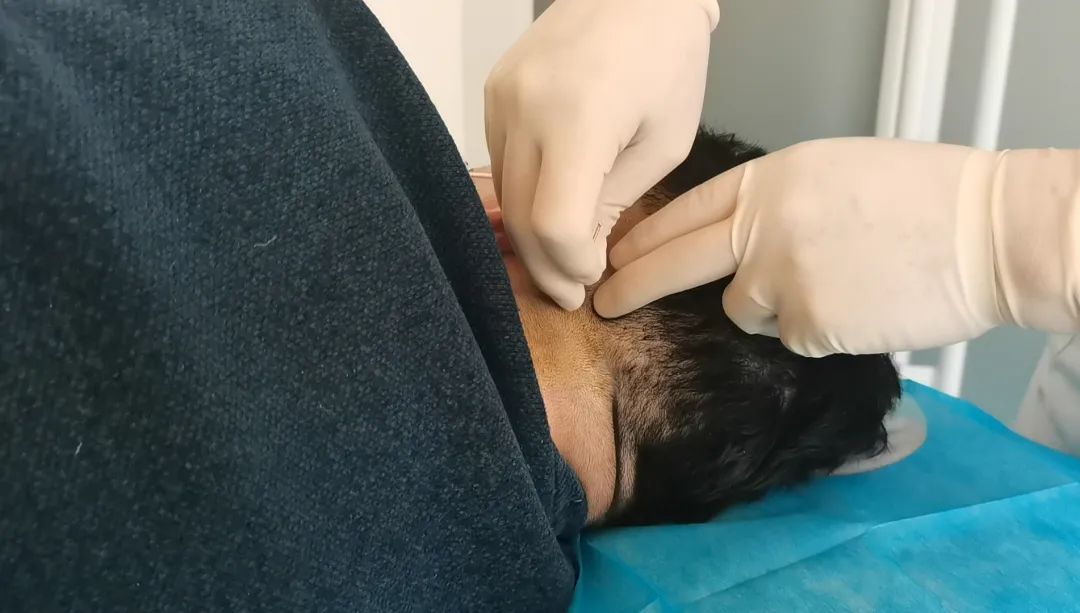 淄博市中医医院疼痛科,淄博中西医结合医院疼痛科怎么样