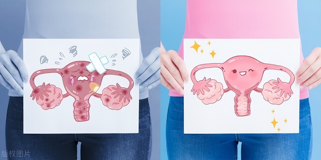 为什么女性“下面”会发臭、有异味？医生：多半是3个原因导致