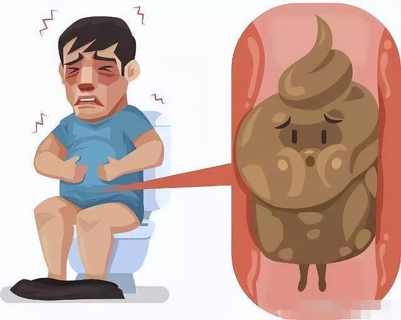 人体有宿便要如何处理,体内宿便有几斤