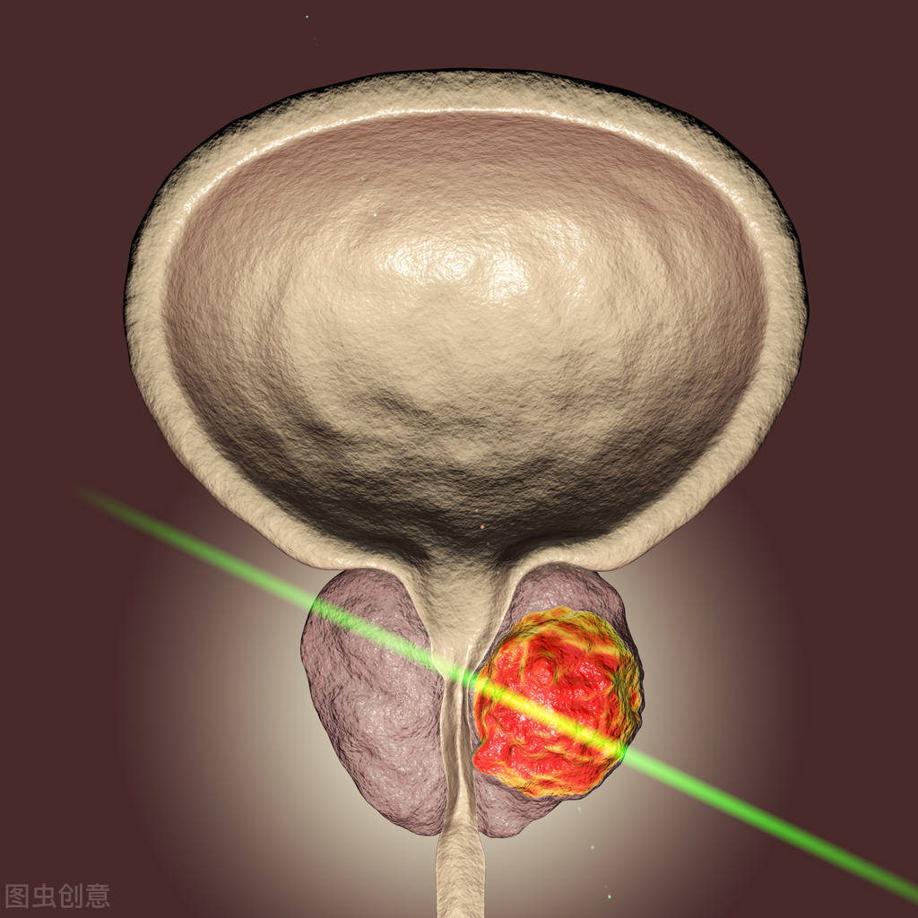 即将上市第一股,第一只上市破发的股票