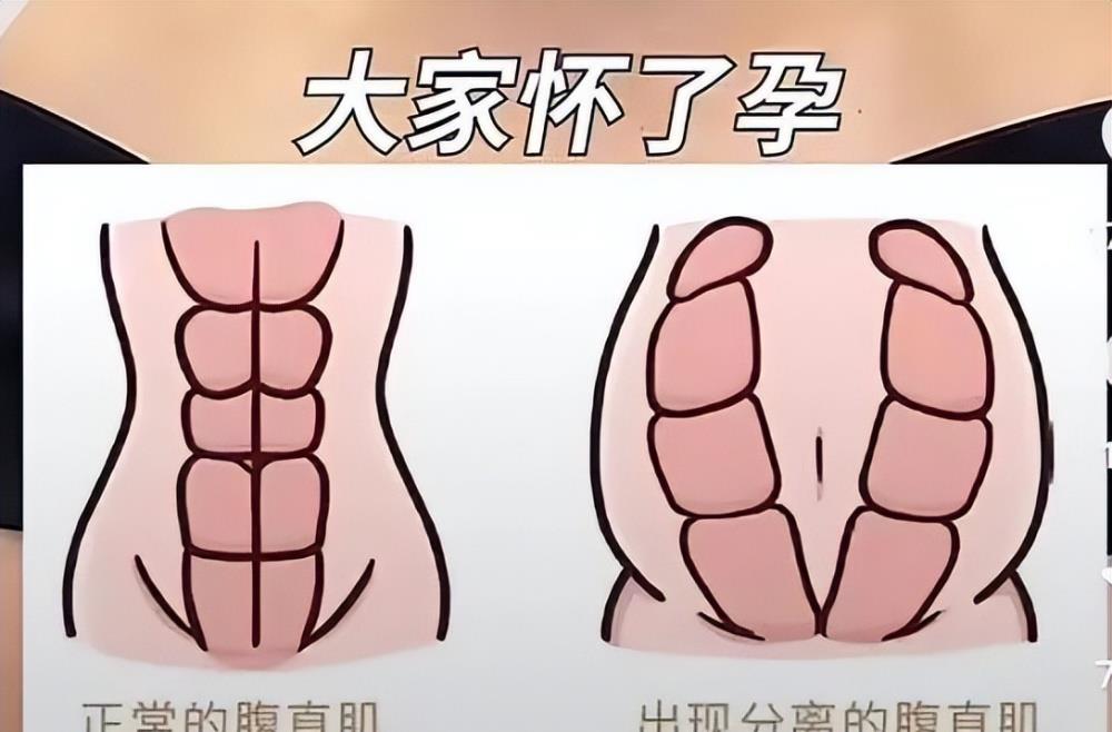 何洁减肥成功90天减重30斤,何洁产后减肥成功案例