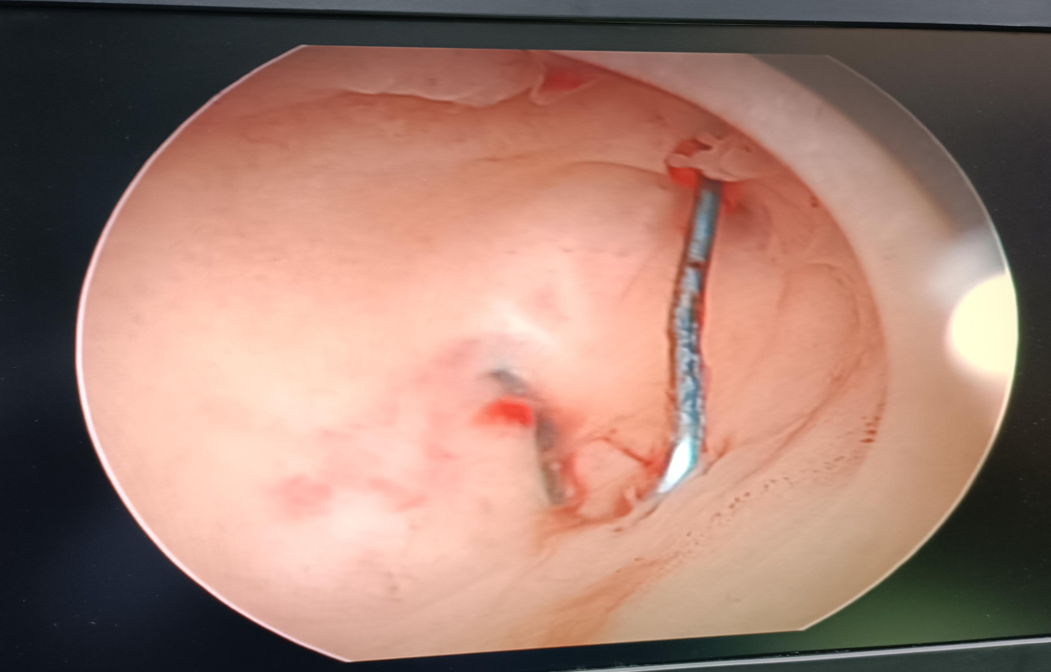 株洲田心医院妇产科专家,株洲市中心医院田心院区妇科医生