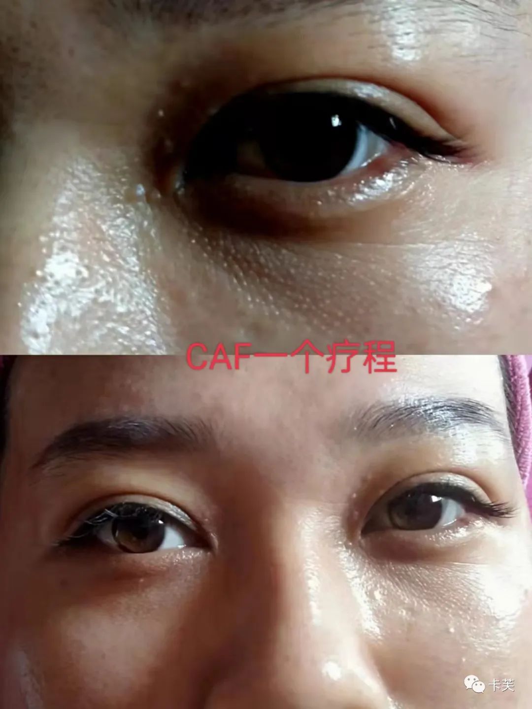 羊胚胎素冻干冰晶眼部精华液，平干纹，淡黑圈，收眼袋，美目传情