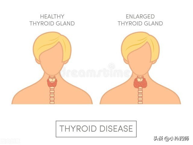 甲状腺结节中医还是西医好,甲状腺结节中医和西医哪个效果好