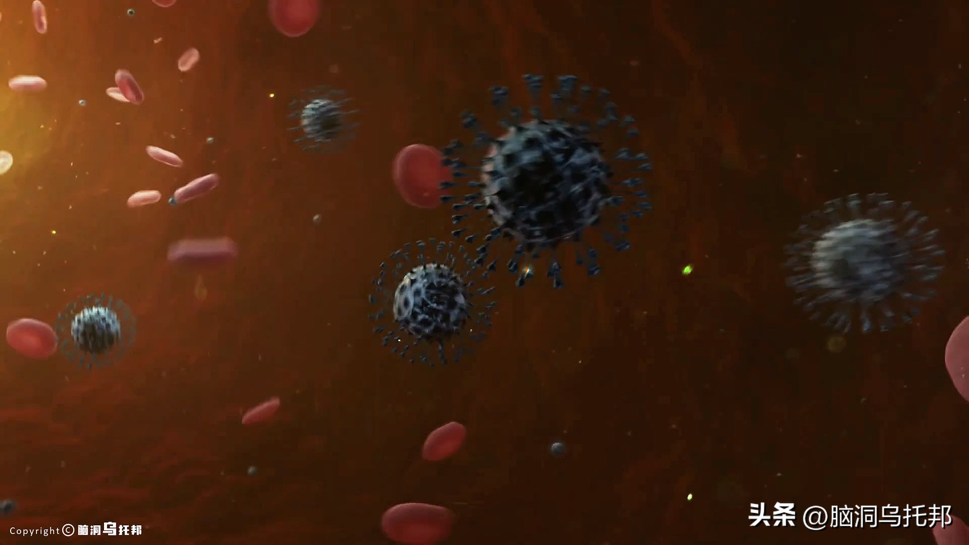 无症状感染是因为体质差吗,为什么有的人感染症状轻