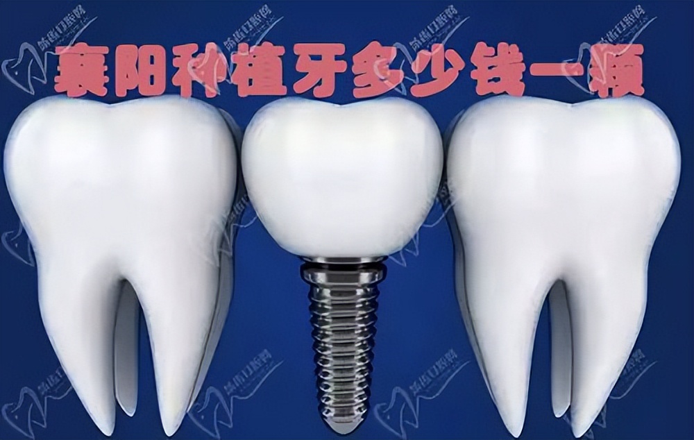 襄阳口腔牙齿种植价格,襄阳种植牙价格是多少钱