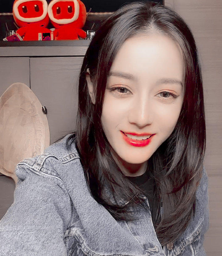 盘点女明星发际线危机,女明星秃头前后对比