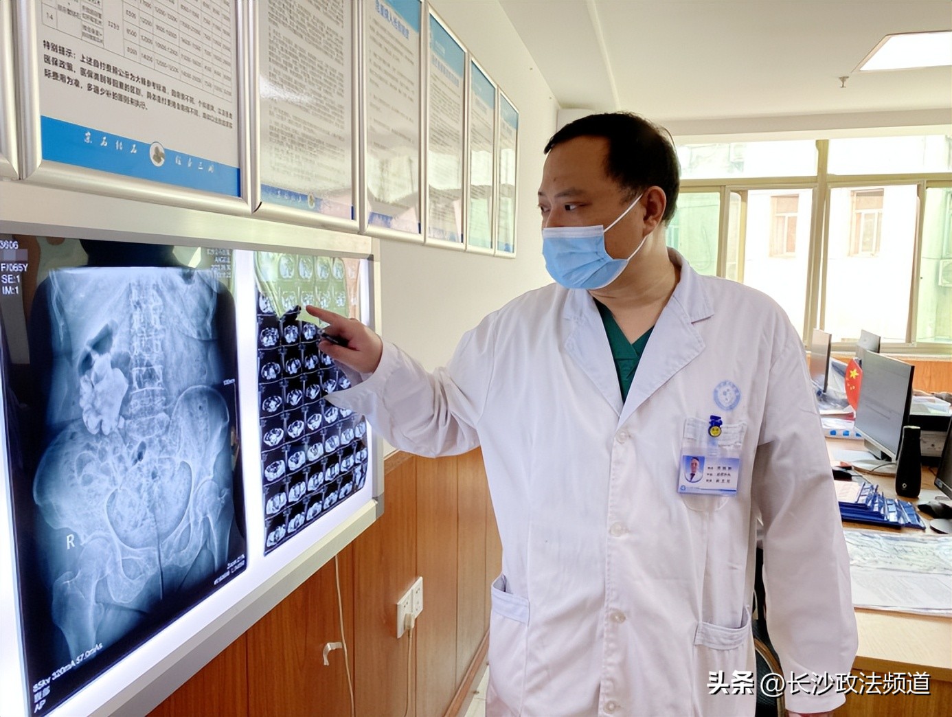 92岁高龄老人结石,83岁老奶奶胆囊结石1.5厘米