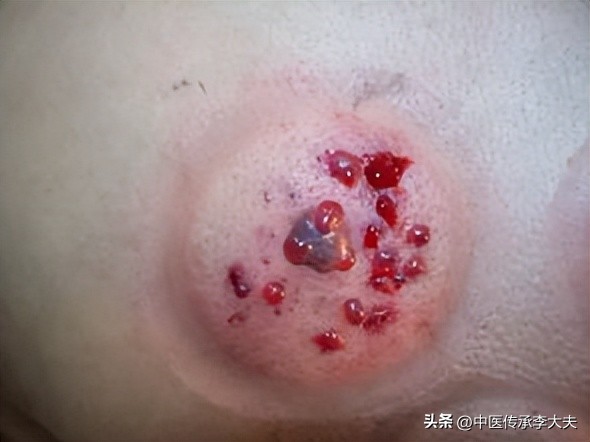 眼袋大是肾不好的原因吗,眼袋很大是不是肝不好