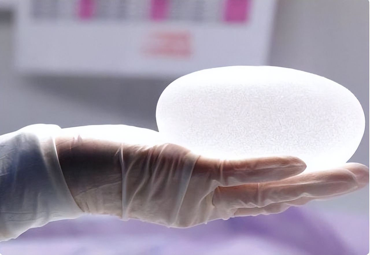 做了假体隆胸后需要祛疤吗,假体隆胸取出可以马上重新做吗