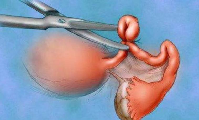 安全套真的防病吗,安全套真的安全吗