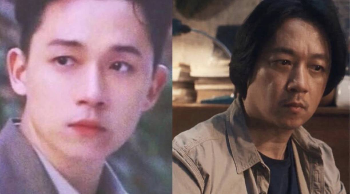 明星脸部僵硬的图片,很多明星脸僵是怎么回事