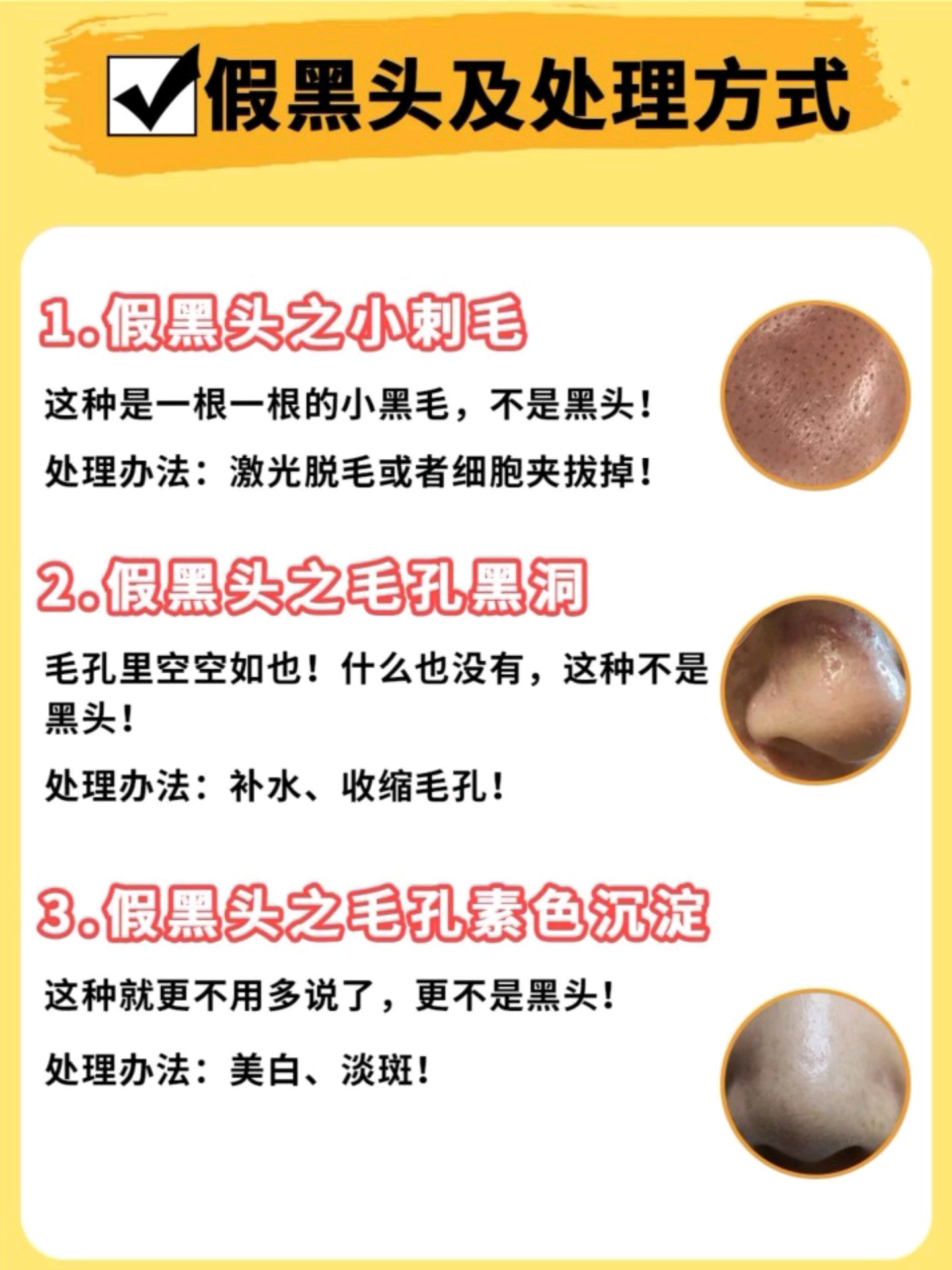 怎么去黑头好用又有效,黑头比较严重祛黑头最有效的方法