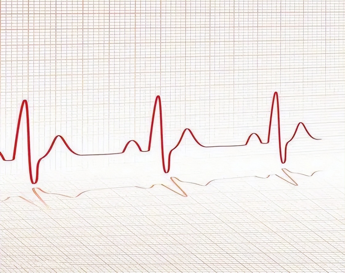 最新国际正常心率范围,心跳多少次算正常范围