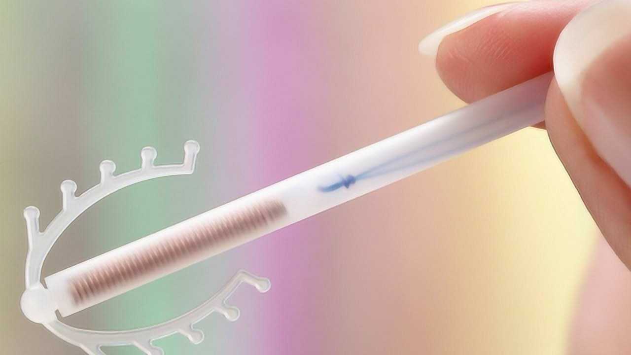 中国第一批“上环”的女性，医生直言：30年了，难逃出这4种结局