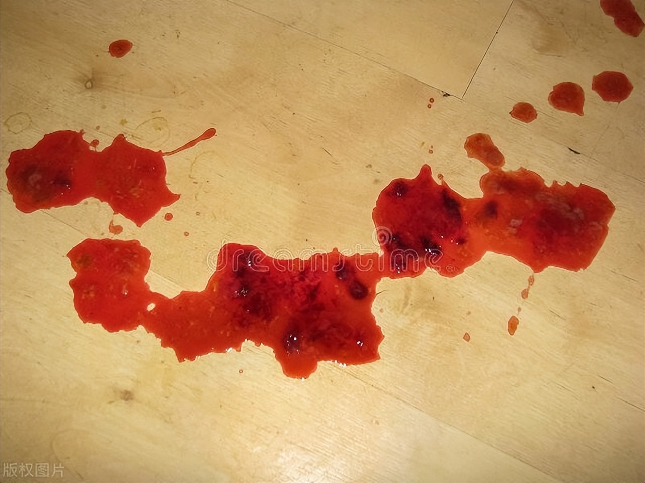 “医生，我痔疮都切了，为啥还便血？”警惕：这种情况一定要重视