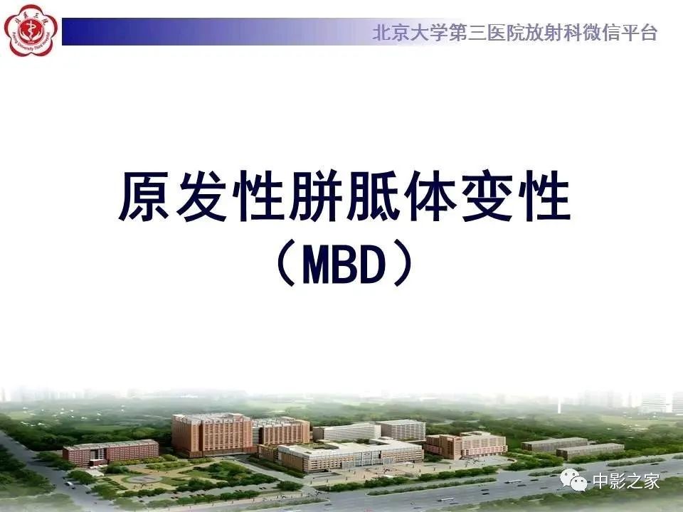 什么叫原发性胼胝体变性,原发性胼胝体变性治疗多少钱