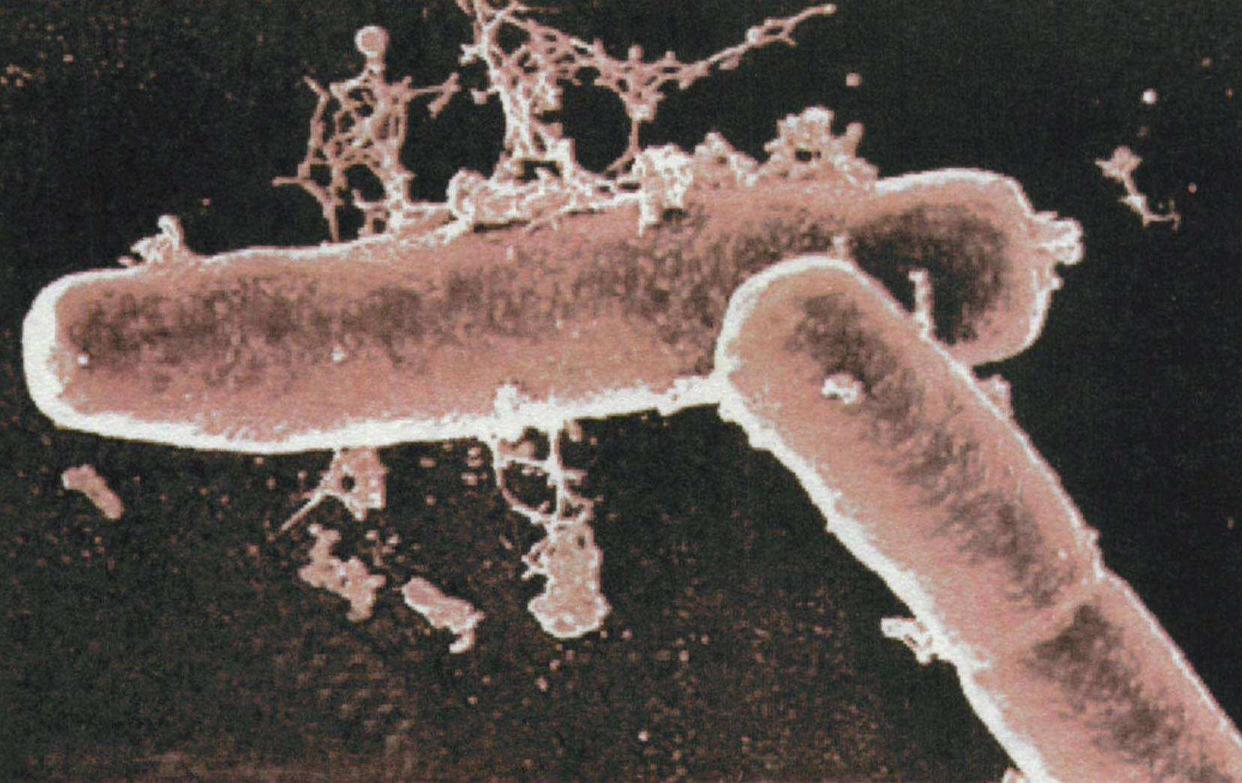 八种性传播疾病有哪些,7种疾病会传播