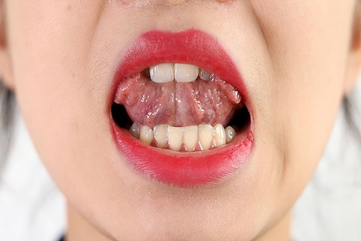 速效救心丸还有其他什么作用,速效救心丸有几种什么病可以吃