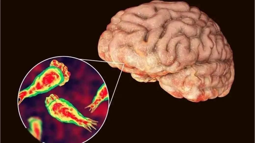 食脑虫为什么会进入脑子,食脑虫是吃脑子的吗