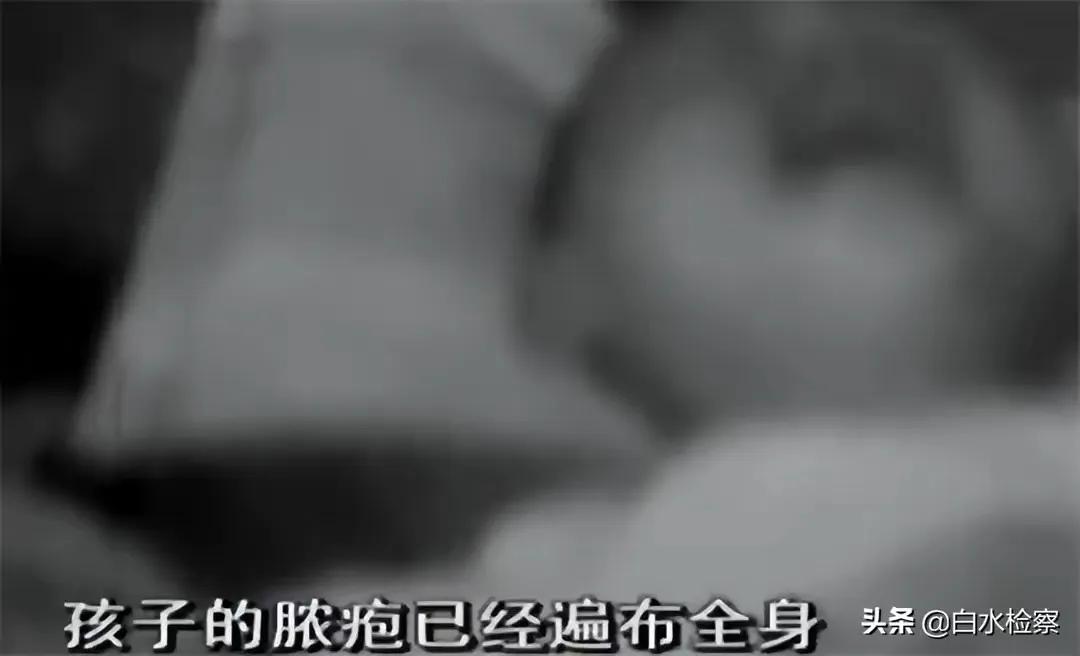 孩子药浴洗出绝症母亲肠子悔青,给孩子洗药浴洗出绝症