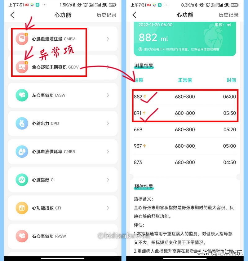 无需采血的检测仪,dido智能手表y18s测评