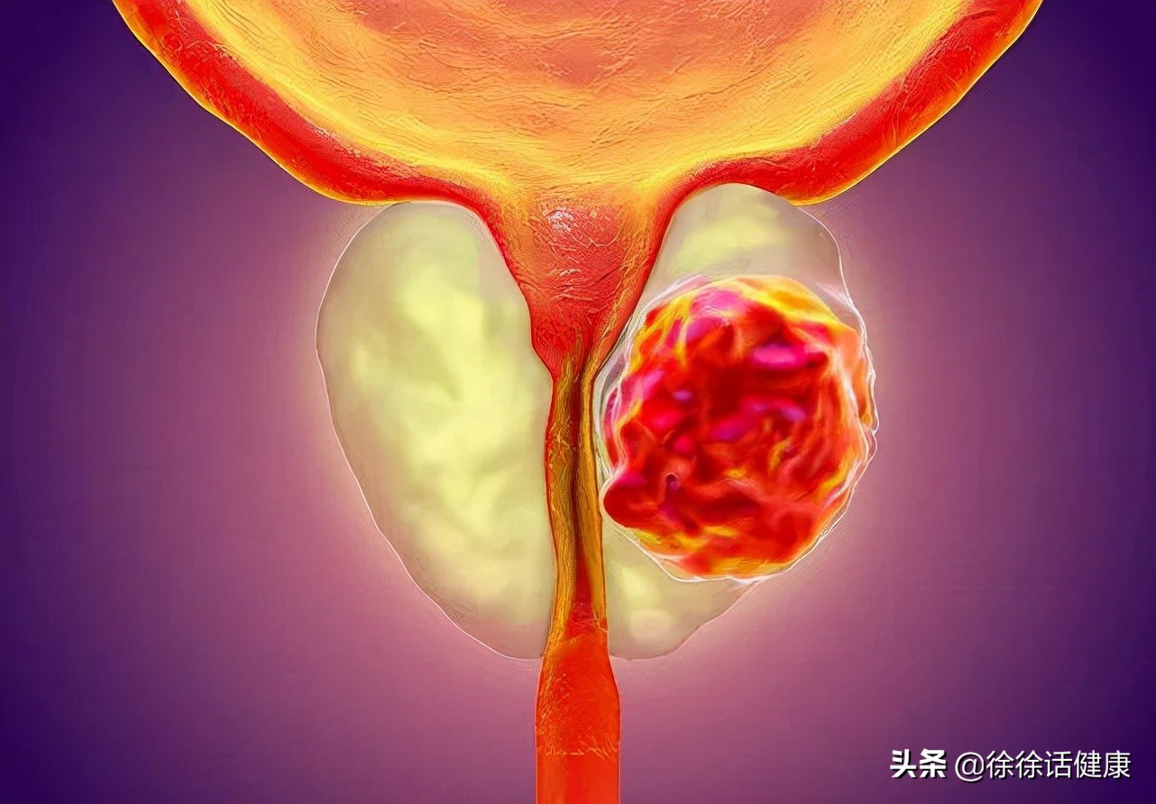 肿瘤标志物正常代表没有癌吗,肿瘤标志物都代表啥