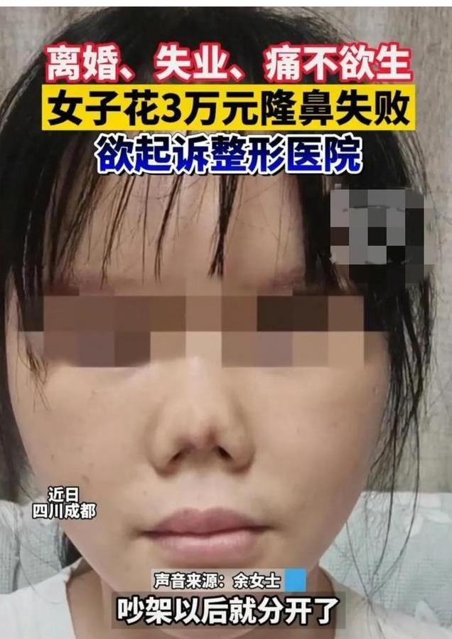 整容朝天鼻案例,朝天鼻整容成功案例