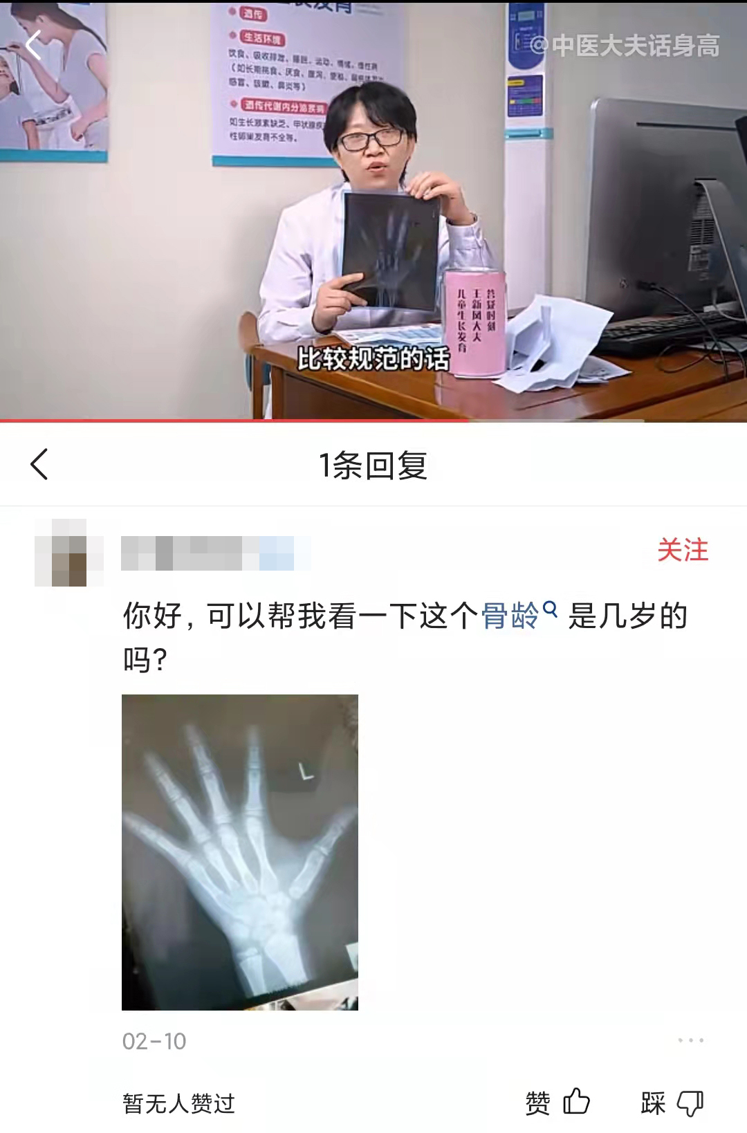 拍骨龄片的正确姿势,如何通过骨龄片看骨龄