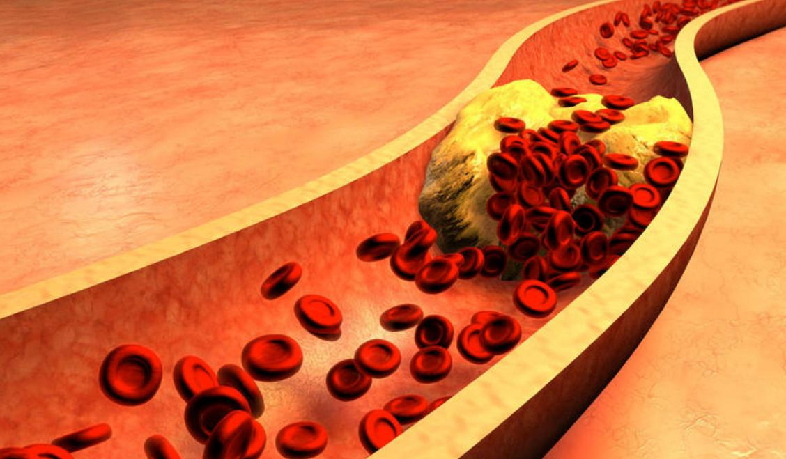 糖尿病初期是不是不能吃太好的药,糖尿病的功能性损害怎么治疗