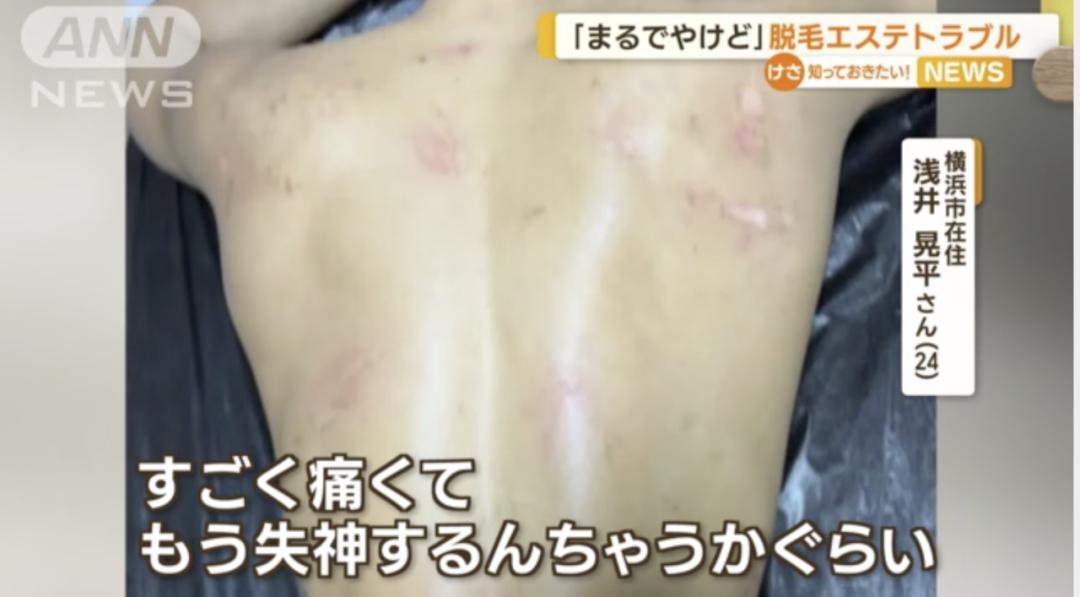 无良女医生非法做手术,女子被假医生做隆胸手术