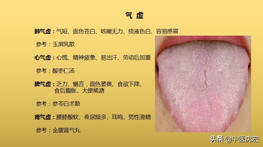 气虚阳虚内热的症状,阴虚内热气虚体质怎么调理