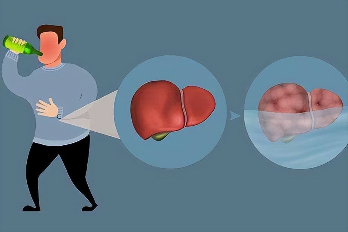 喝酒后头晕脑胀的怎么解决,喝酒多了头晕脑胀是怎么回事