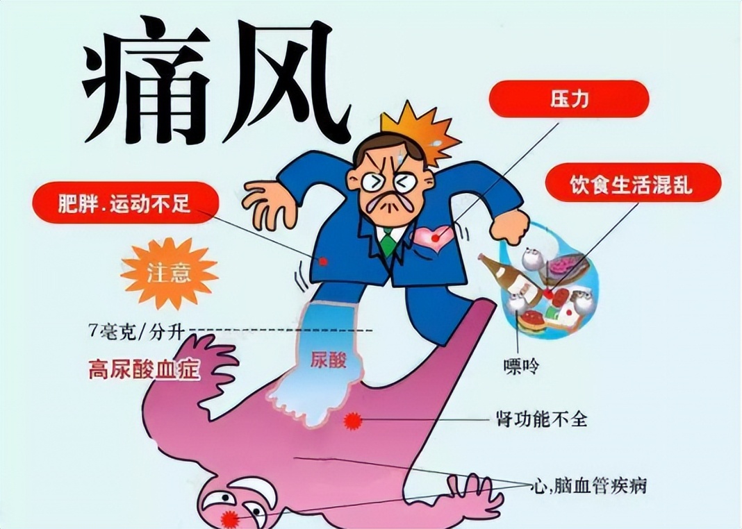 查出高尿酸这五件事再难也要坚持,高尿酸有五个表现症状图片