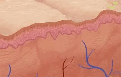 有什么方法能淡化妊娠纹呢,淡化妊娠纹用这个方法简单又实用