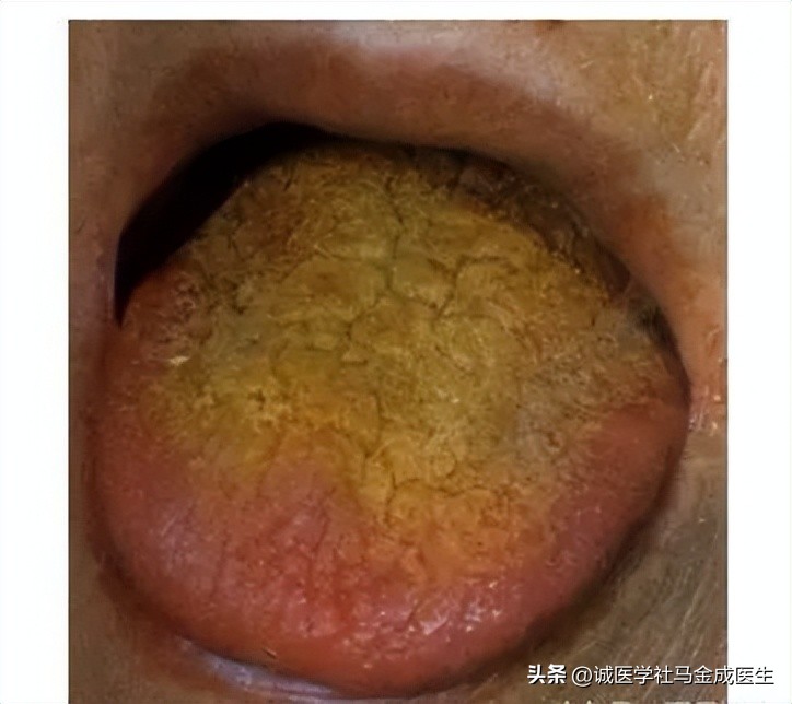 中医如何看大便不通畅的原因,大便不畅按什么穴位最好