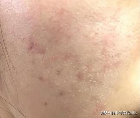 精华液和精华露和精华油的区别,精华油和精华液还有精华水的区别