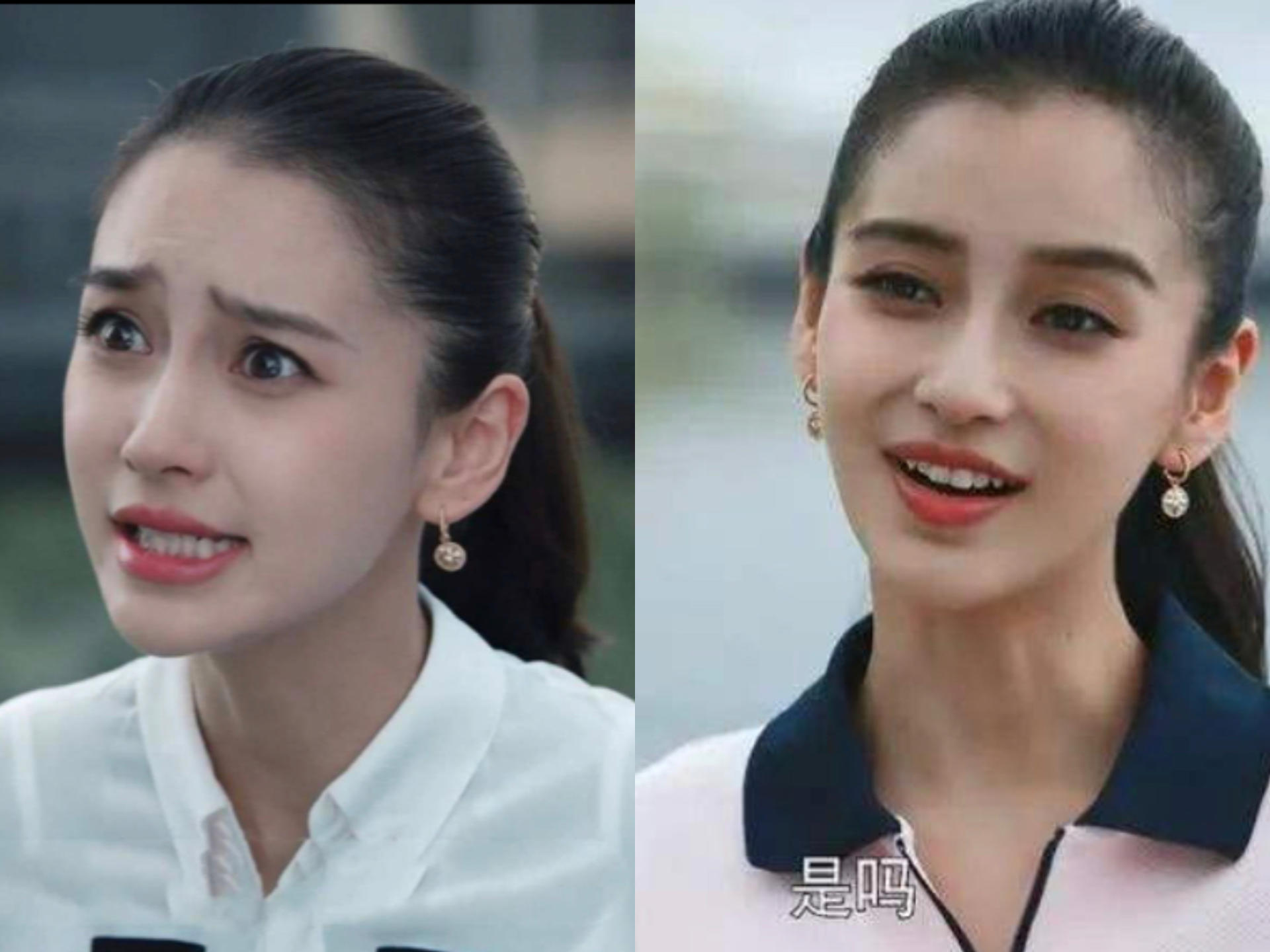 哪些明星整容后遗症越来越严重,整容明星后遗症对比图片