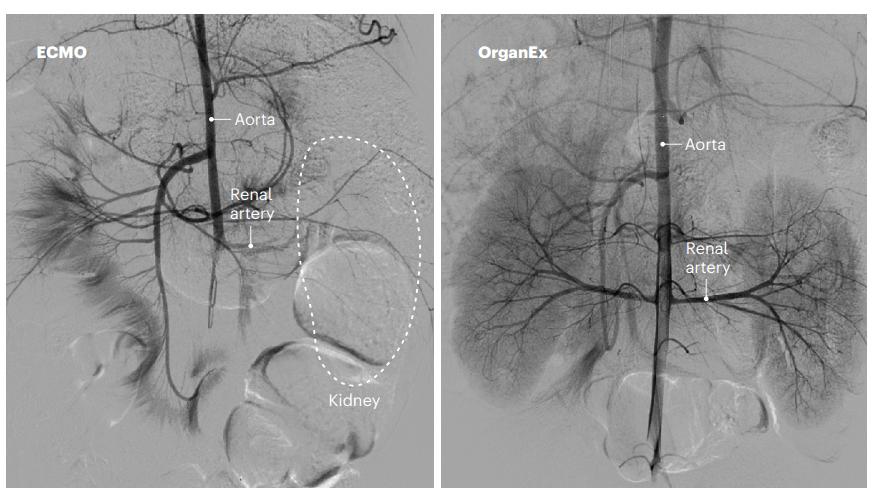 美国救活5个小时死亡的猪,美国科学家做的复活实验