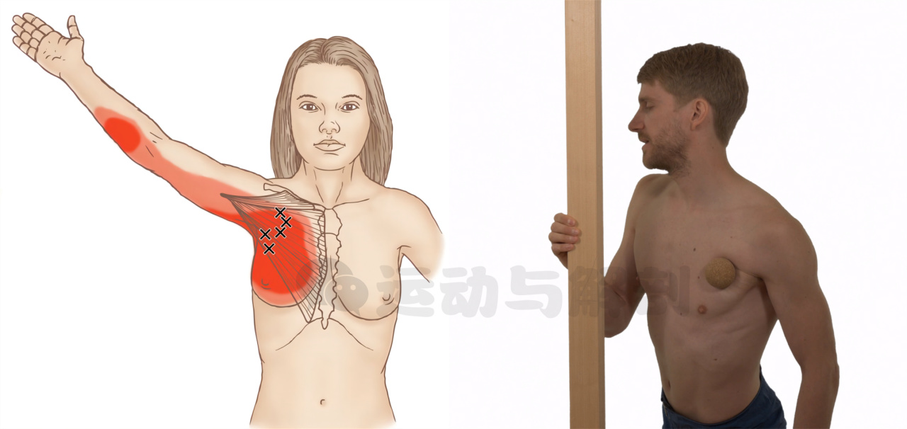 胸大太松怎样练紧致,胸大肌太过紧张要松解多久