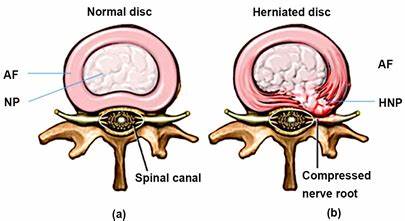 老年人腿无力的康复锻炼方法,老年人腿无力如何锻炼