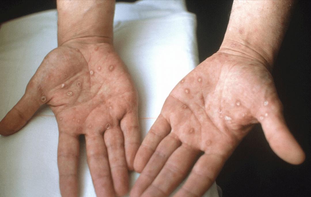 被性开放毁掉的年轻人！拿生命发生的关系，只有一次也能摧毁你