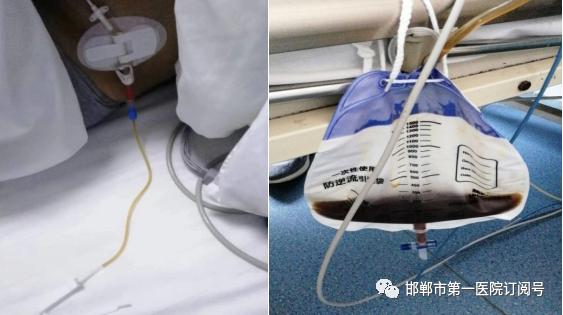 疫情期间危重症抢救流程,新冠疫情应对急危重病人抢救流程