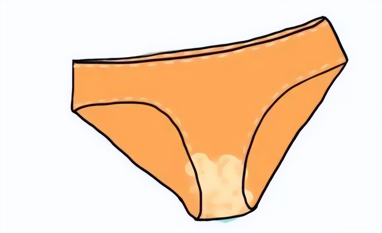 女人67岁得了子宫癌有什么症状呢,55岁妇女子宫脱垂最好解决办法