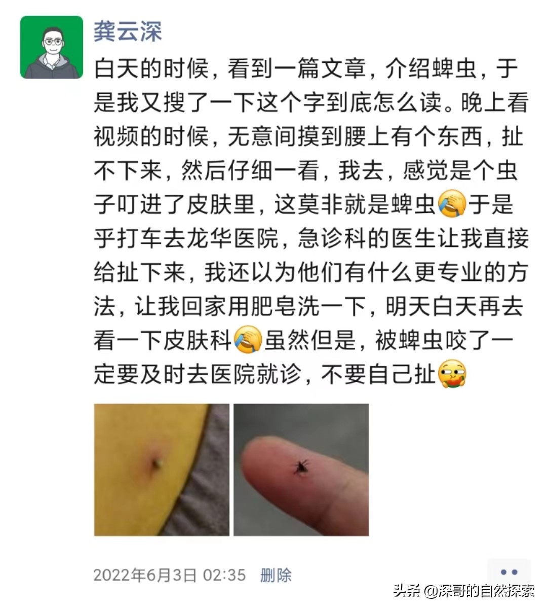 在深圳被小黑虫咬了,户外游玩被蜱虫咬到的视频